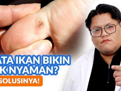 Waspada Penyakit Mata Ikan