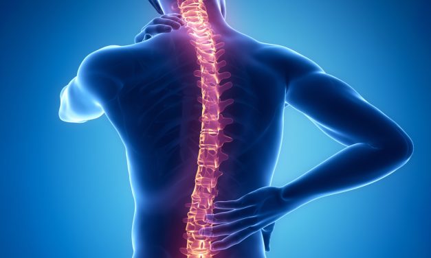 Kelainan Skoliosis Berbahaya Hingga Menyebabkan Komplikasi